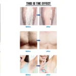 Painless Physical Crystal Hair Remover - UK HOT DEALS - Image 2