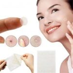 Hydrocolloid Acne Patches – Best Selling Product in UK - Image 2
