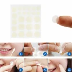 8PCS Hydrocolloid Acne & Skin Tag Healing Patches - Image 2